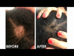 Image sur Virgin Hair Fertilizer, crème revitalisante et anti-pellicules pour la croissance rapide des cheveux -150 g