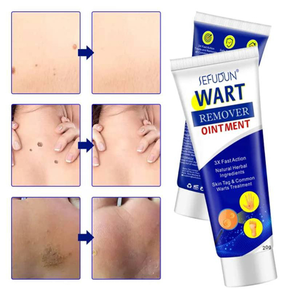 Agrandir l'image de wart remover Image de wart remover