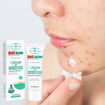 Image sur Creme de visage anti acne, aichus beauty, 20g