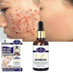 Image sur Serum facial, Anti-acne éclaircissant , formule médical, 30ml