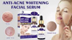 Image sur Serum facial, Anti-acne éclaircissant , formule médical, 30ml