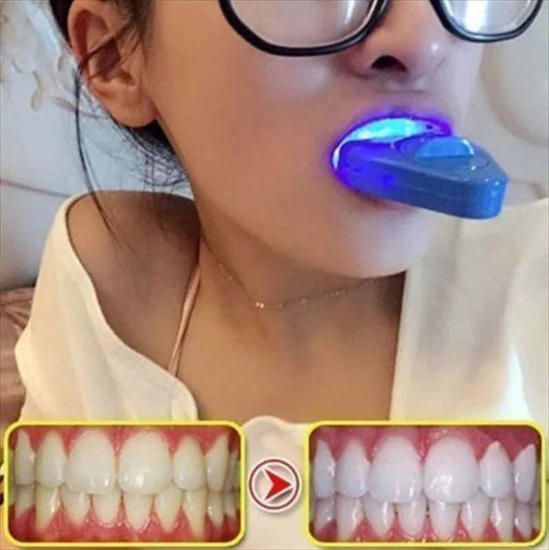 Image sur Soins bucco-dentaires, WHITELIGHT, Lampe de blanchiment des dents à lumière blanche, 220g