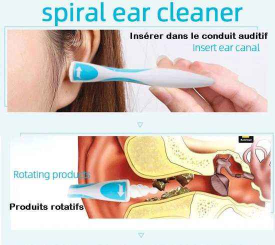 Nettoyeur d’oreille rotatif en spirale pour enfants et adultes.
