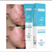 Image sur Gel visage anti-acné MOOYAM – Efficace dès 12h – Antitaches –Élimination points noirs – Garantie 6 mois