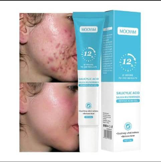 Image sur Gel visage anti-acné MOOYAM – Efficace dès 12h – Antitaches –Élimination points noirs – Garantie 6 mois