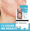 Image sur Gel visage anti-acné MOOYAM – Efficace dès 12h – Antitaches –Élimination points noirs – Garantie 6 mois